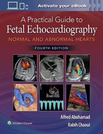 A Practical Guide to Fetal Echocardiography cover