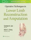 Operative Techniques in Lower Limb  Reconstruction and Amputation cover