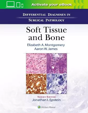 Differential Diagnoses in Surgical Pathology: Soft Tissue and Bone cover