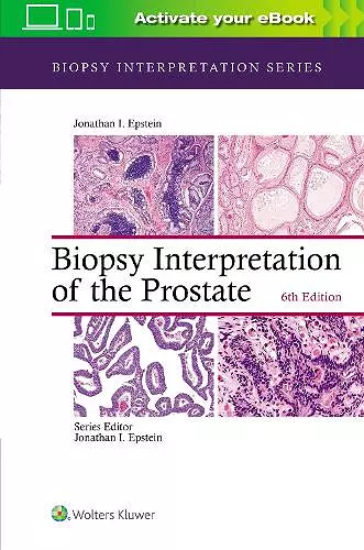 Biopsy Interpretation of the Prostate cover