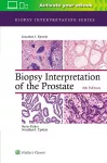 Biopsy Interpretation of the Prostate cover