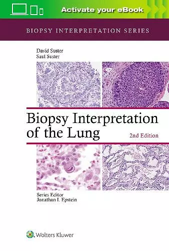 Biopsy Interpretation of the Lung cover