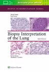 Biopsy Interpretation of the Lung cover