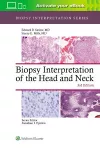 Biopsy Interpretation of the Head and Neck cover