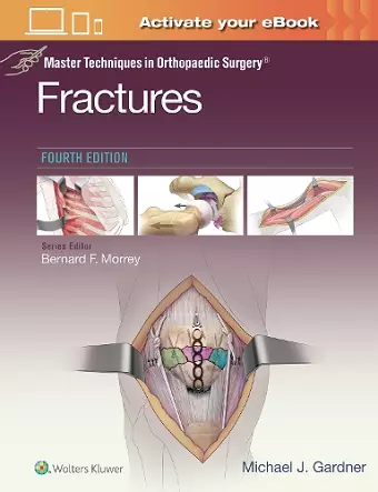Master Techniques in Orthopaedic Surgery: Fractures cover