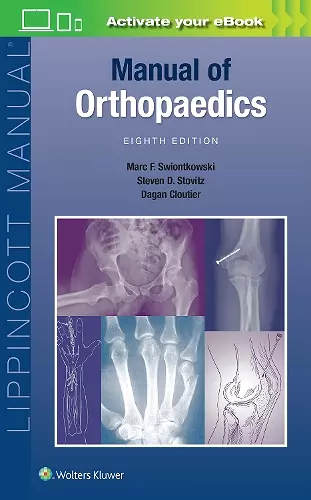 Manual of Orthopaedics cover