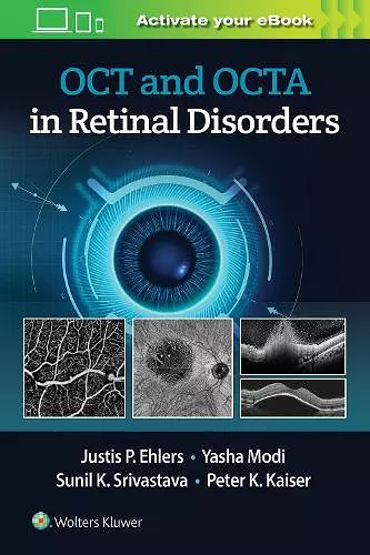 OCT and OCTA in Retinal Disorders cover