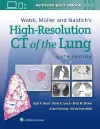 Webb, Müller and Naidich's High-Resolution CT of the Lung cover