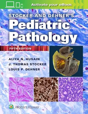 Stocker and Dehner's Pediatric Pathology cover