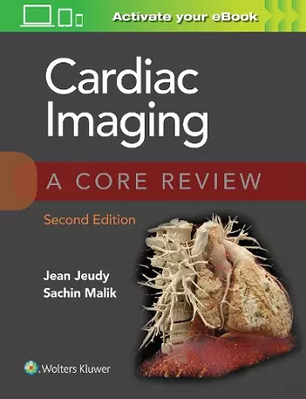 Cardiac Imaging: A Core Review cover