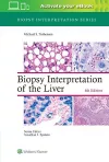 Biopsy Interpretation of the Liver cover