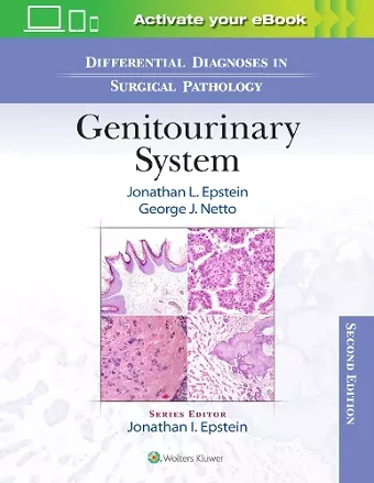 Differential Diagnoses in Surgical Pathology: Genitourinary System cover