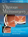 Vitreous Microsurgery cover