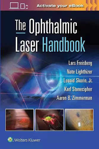 The Ophthalmic Laser Handbook cover