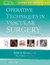 Operative Techniques in Vascular Surgery: Print + eBook with Multimedia cover