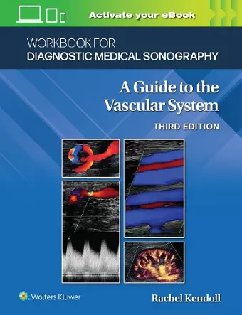 Workbook for Diagnostic Medical Sonography: The Vascular Systems cover