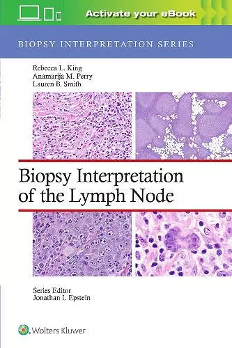 Biopsy Interpretation of the Lymph Node: Print + eBook with Multimedia cover