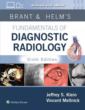 Brant & Helms' Fundamentals of Diagnostic Radiology: Print + eBook with Multimedia cover