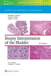 Biopsy Interpretation of the Bladder: Print + eBook with Multimedia cover
