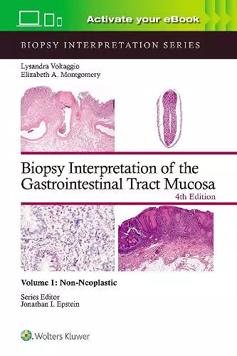 Biopsy Interpretation of the Gastrointestinal Tract Mucosa Volume 1 cover