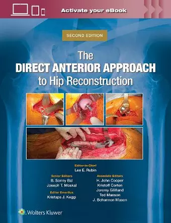 The Direct Anterior Approach to Hip Reconstruction cover