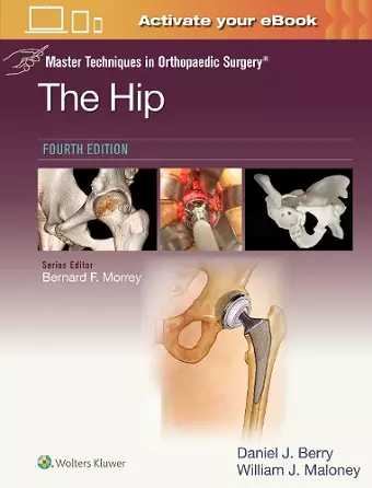 Master Techniques in Orthopaedic Surgery: The Hip: Print + eBook with Multimedia cover