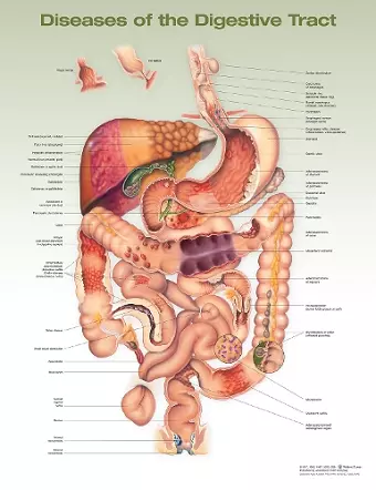 Diseases of the Digestive Tract Anatomical Chart cover