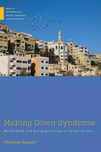 Making Down Syndrome cover