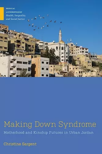 Making Down Syndrome cover