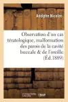 Observation d'Un Cas Tératologique Rare: Malformation Des Parois de la Cavité Buccale cover