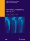 Revision of loose femoral prostheses with a stem system based on the "press-fit" principle cover