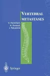 Vertebral metastases cover