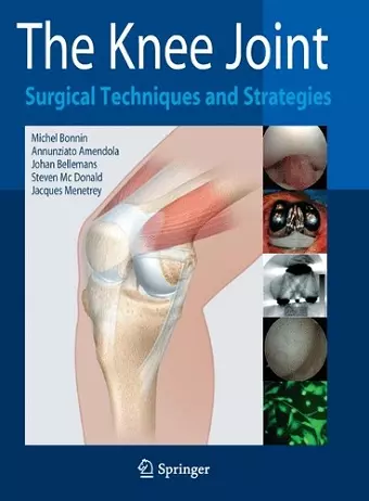 The Knee Joint cover