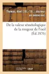 de la Valeur Séméiologique de la Rougeur de l'Oeil cover