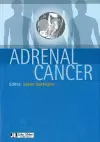 Adrenal Cancer cover