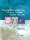 Surgical Neuropathology of Focal Epilepsies cover