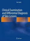 Clinical Examination and Differential Diagnosis of Skin Lesions cover