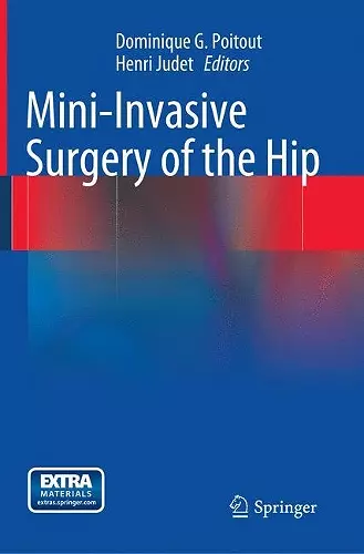 Mini-Invasive Surgery of the Hip cover