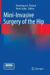 Mini-Invasive Surgery of the Hip cover