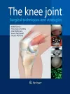 The Knee Joint cover