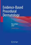 Evidence-Based Procedural Dermatology cover