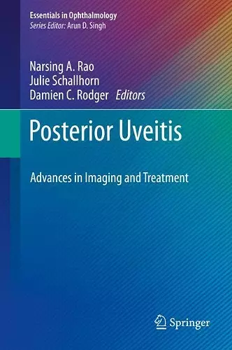 Posterior Uveitis cover