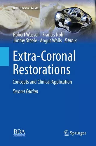 Extra-Coronal Restorations cover