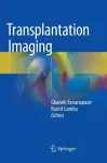 Transplantation Imaging cover