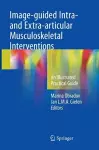 Image-guided Intra- and Extra-articular Musculoskeletal Interventions cover