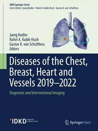 Diseases of the Chest, Breast, Heart and Vessels 2019-2022 cover