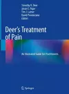 Deer's Treatment of Pain cover