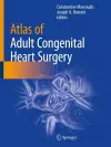 Atlas of Adult Congenital Heart Surgery cover