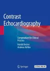 Contrast Echocardiography cover