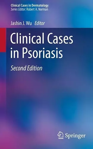 Clinical Cases in Psoriasis cover